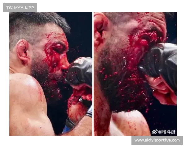 圣丹尼斯五连胜势头正盛，轻量级排名有望进一步提升